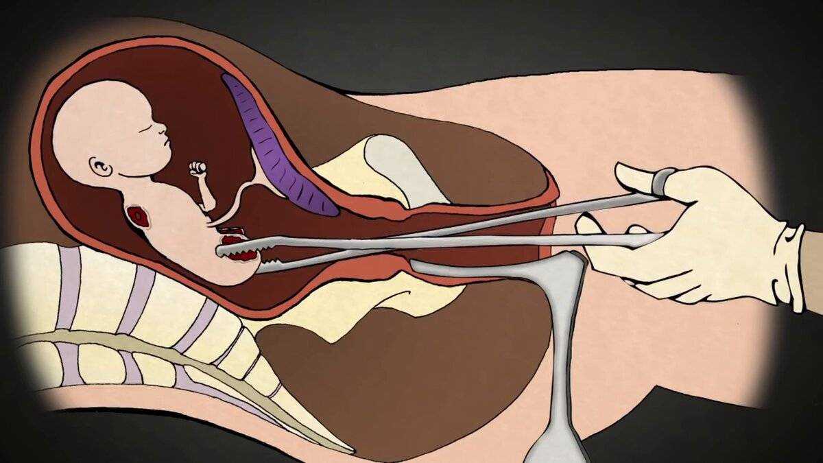 Секс после родов - когда можно и как предохраняться | центр медицины плода на чистых прудах