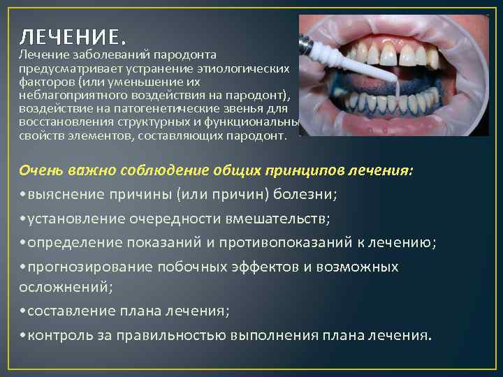 10 этапов лечения пародонтоза  Что такое пародонтоз зубов и как лечить его  Появление первых зубов – событие волнительное  Кро  Возможности современной