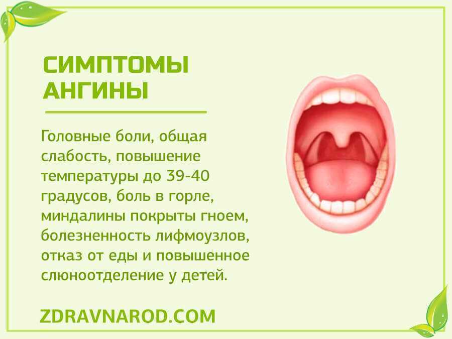 Герпетическая ангина у детей, эффективное лечение герпетической ангины у детей