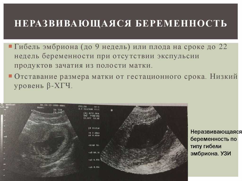 Когда на узи можно увидеть беременность | на каком сроке узи показывает беременность «омикрон - томоград»