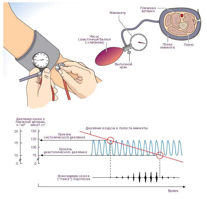 Аускультативный метод (короткова) измерения артериального давления | гипертония