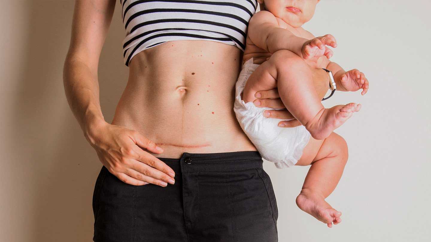 Полезные новости: 7 ошибок, которые мамы допускают с первого дня после родов.