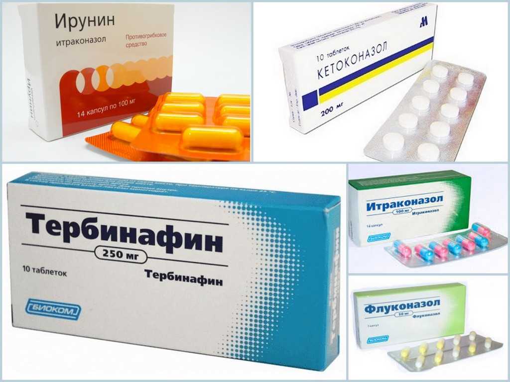 Лучшие противогрибковые препараты: обзор и классификация - «ваш доктор» - ваш медицинский журнал