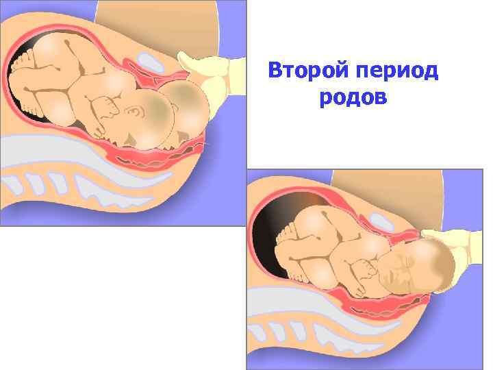Эффективные методы стимуляции сосков перед родами — портал о заболеваниях груди
