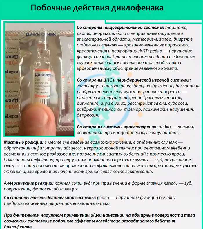 Выбираем мазь на основе диклофенака