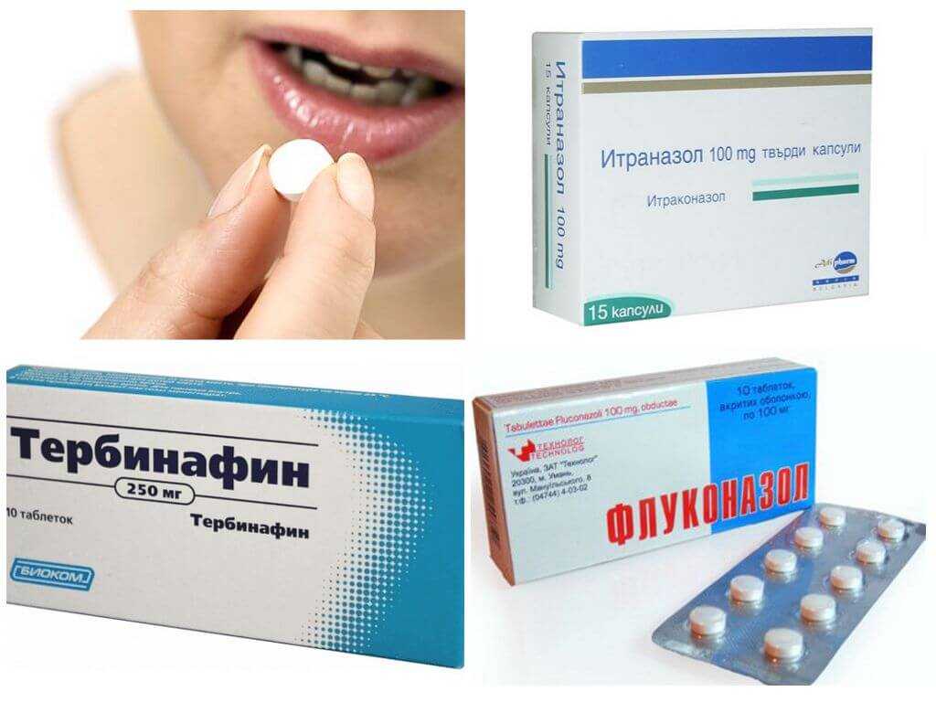 Противогрибковые препараты