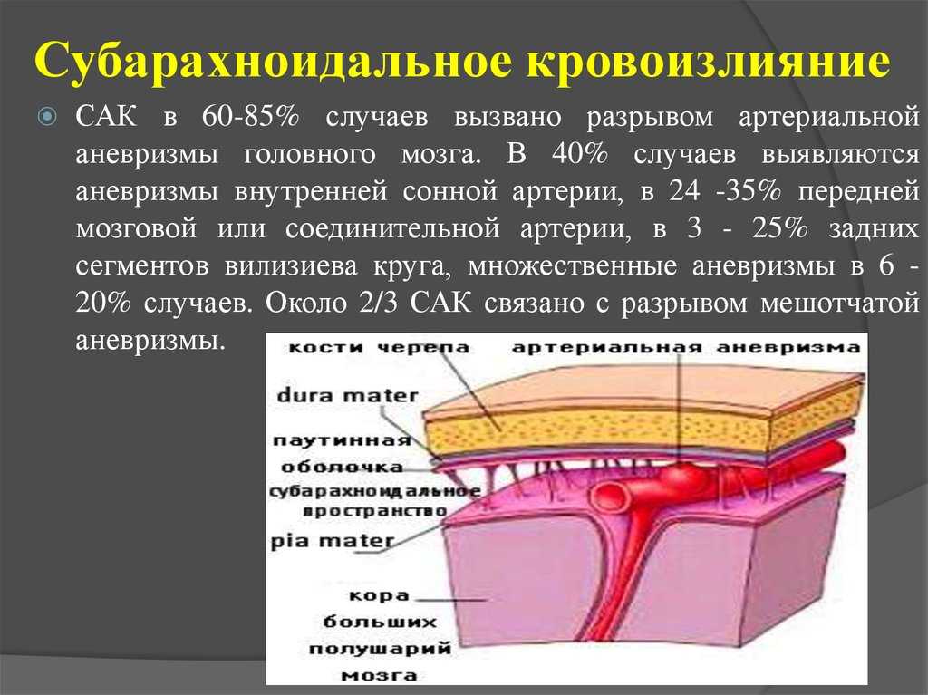 Субарахноидальное кровоизлияние головного мозга: симптомы, лечение, последствия, причины, признаки
