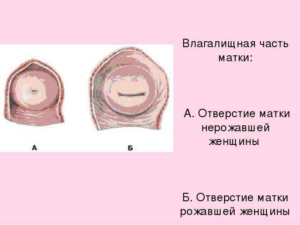 Влагалище после родов: как выглядит и восстанавливается / mama66.ru