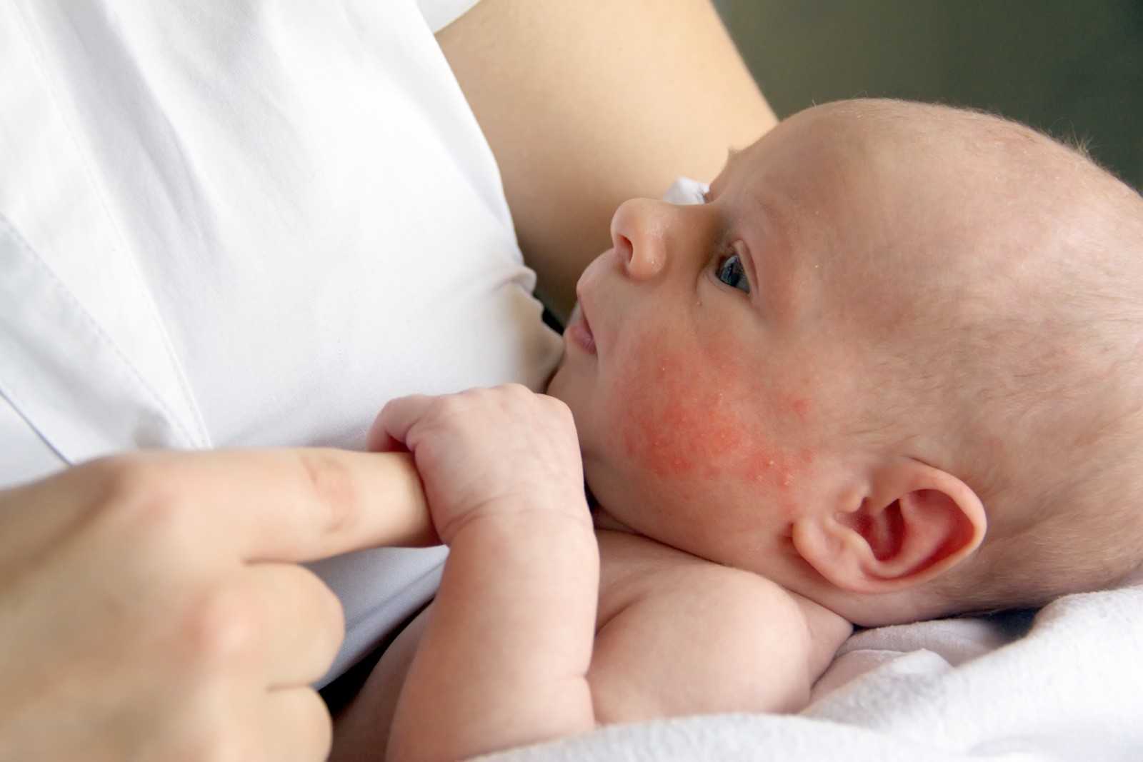 Белые точки на носу у новорожденных | уроки для мам