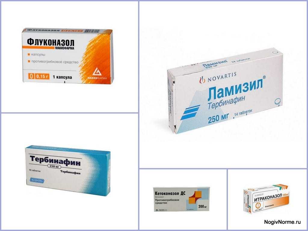 Кетоконазол мазь: заменители, область применения, ограничения и побочные реакции
