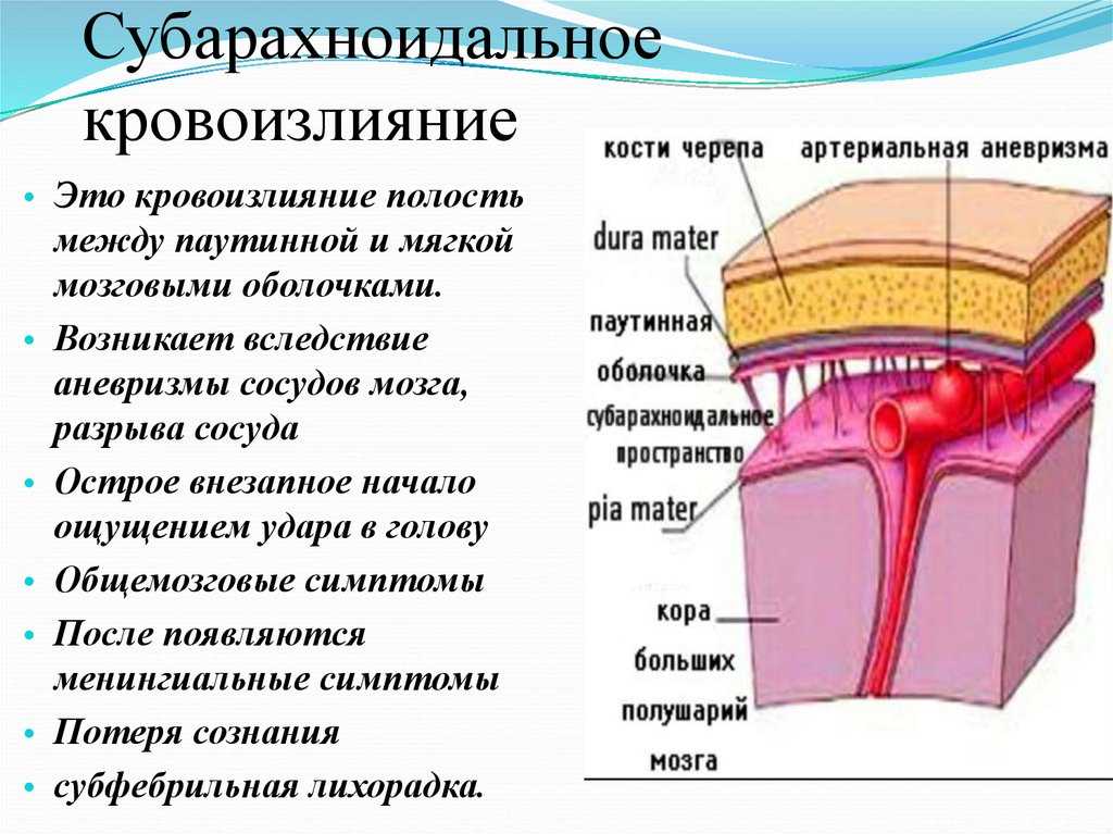 Субарахноидальное кровоизлияние - симптомы болезни, профилактика и лечение субарахноидального кровоизлияния, причины заболевания и его диагностика на eurolab