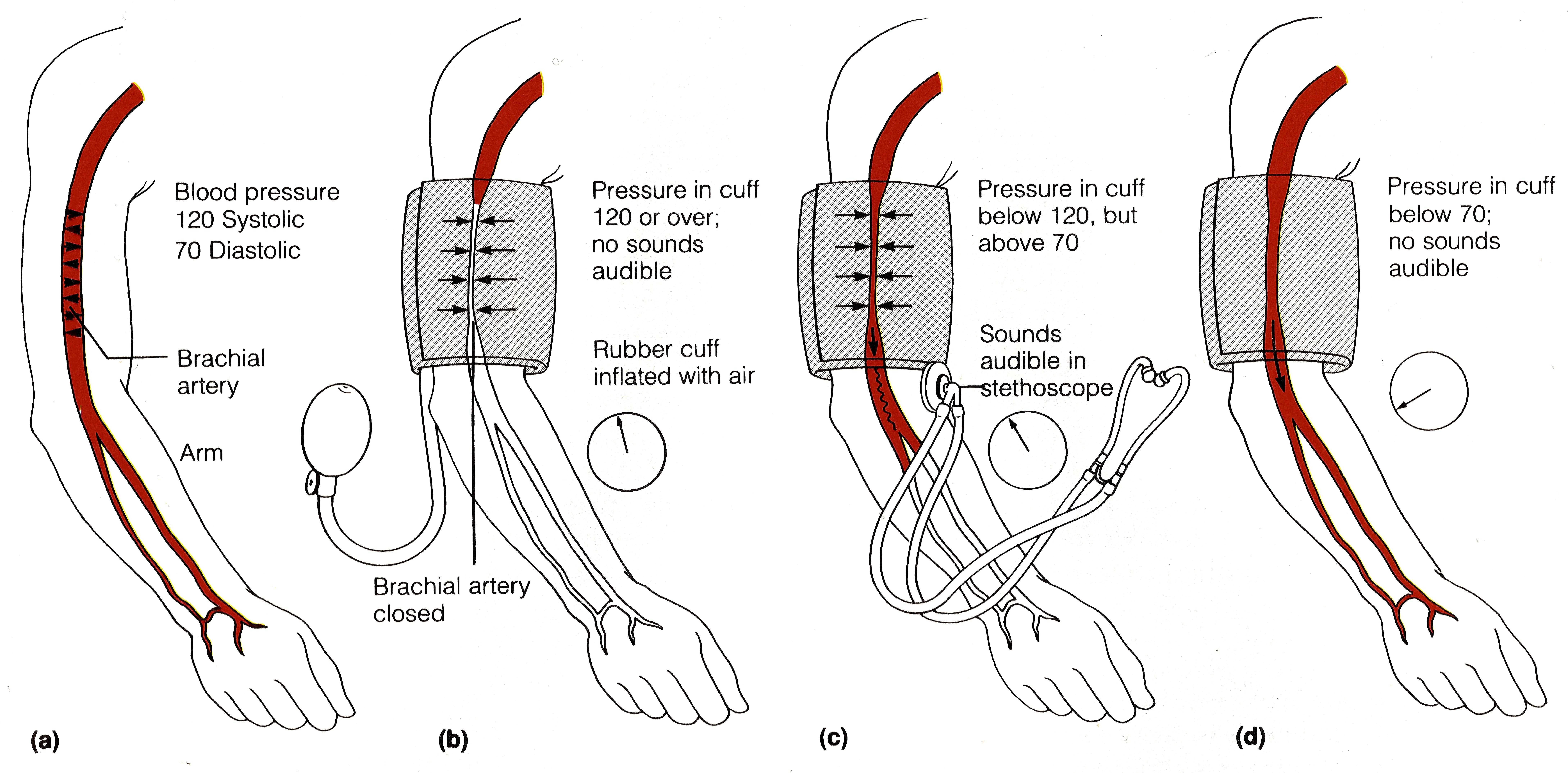 Аускультативный метод измерения артериального давления по короткову