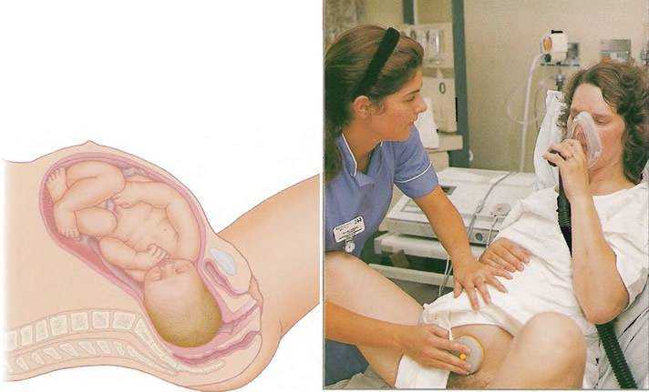 Как восстанавливается организм после родов: основные этапы и рекомендации