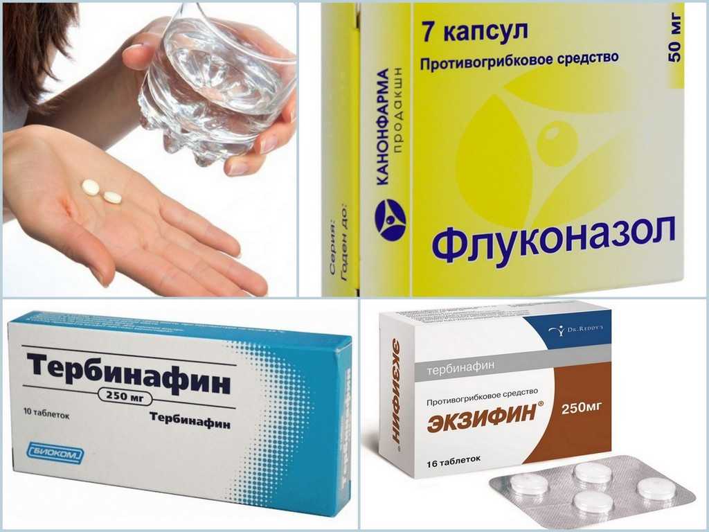 Противогрибковая терапия - описание услуги, при каких болезнях и какие врачи назначают