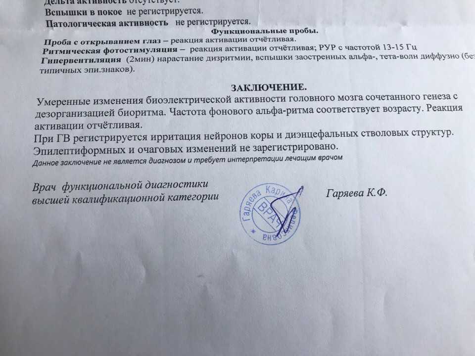 Что такое аневризма: причины, симптомы, диагностика, лечение