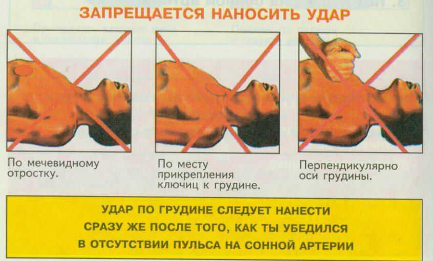 Почему может болеть мечевидный отросток грудины?
