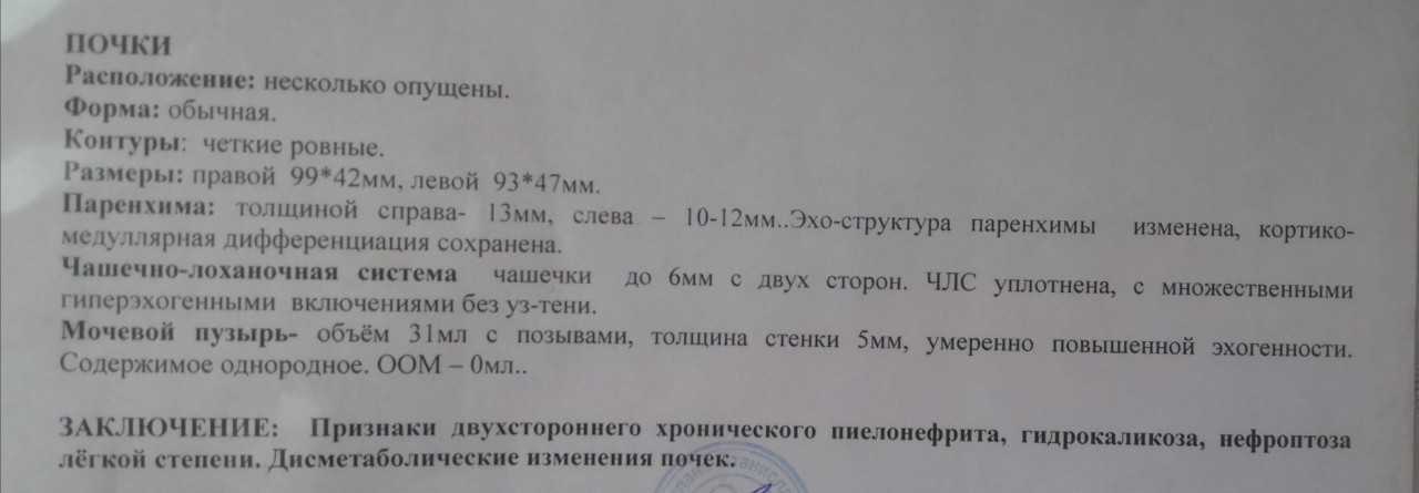 Каликоэктазия почек (левой, правой, обеих): что это такое, симптомы