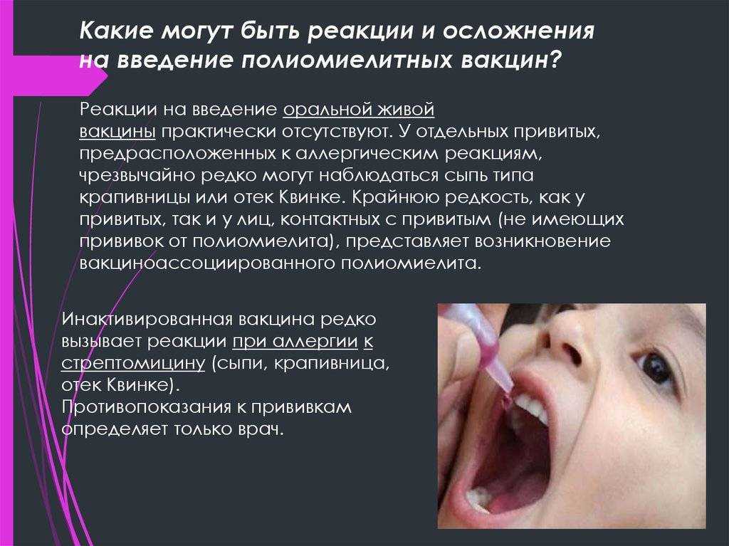 Прививка от полиомиелита детям