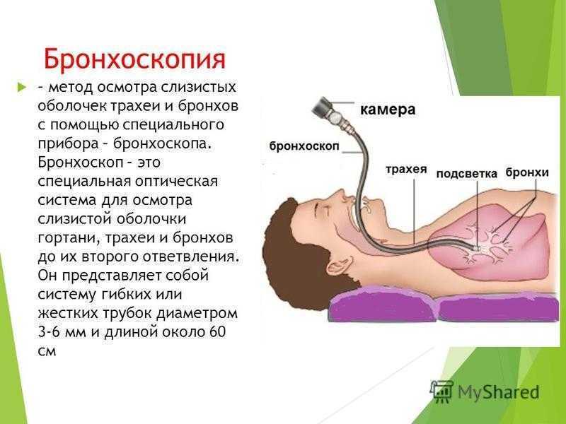 Бронхоскопия - как проводится? виды и показания к исследованию