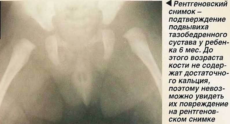 Рентген суставов — коленного, тазобедренного, плечевого, голеностопного | clinic-spine.ru - клиника здорового позвоночника в белгороде