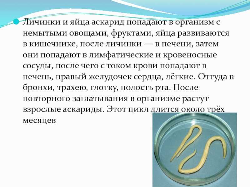 Как выглядят аскариды?