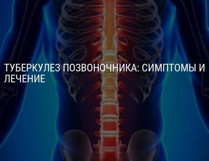 Симптомы туберкулеза у взрослых - формы, симптомы, диагностика и лечение