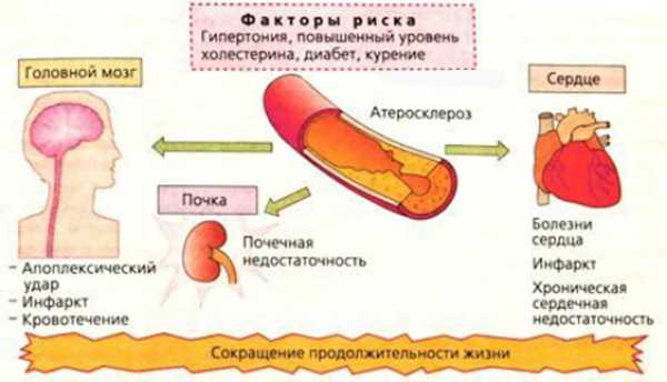 Холестерин: полный гайд по норме, причины появления, советы по продуктам