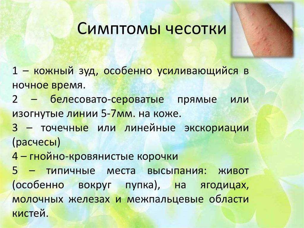 Чесоточный клещ: пути заражения, симптомы, лечение
