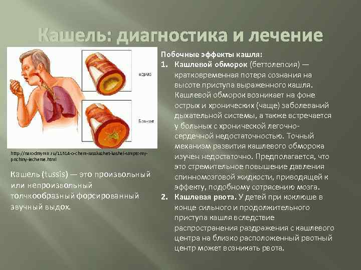 Поверхностный бульбит: симптомы, способы лечения и профилактика