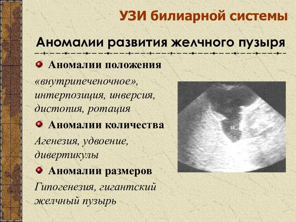 Почему появляется и как лечится билиарная гипертензия?