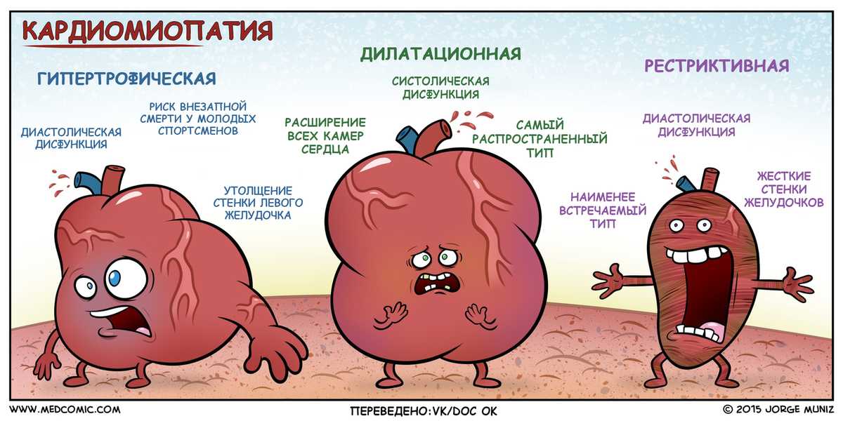 Кардиопатия – причины, симптомы, диагностика и лечение - медком