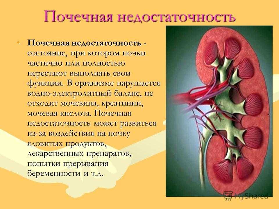 Острая почечная недостаточность