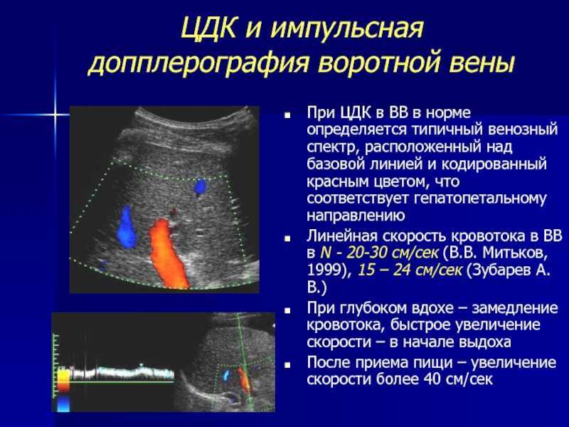 Что такое ультразвуковая допплерография сосудов головы и шеи (уздг)?