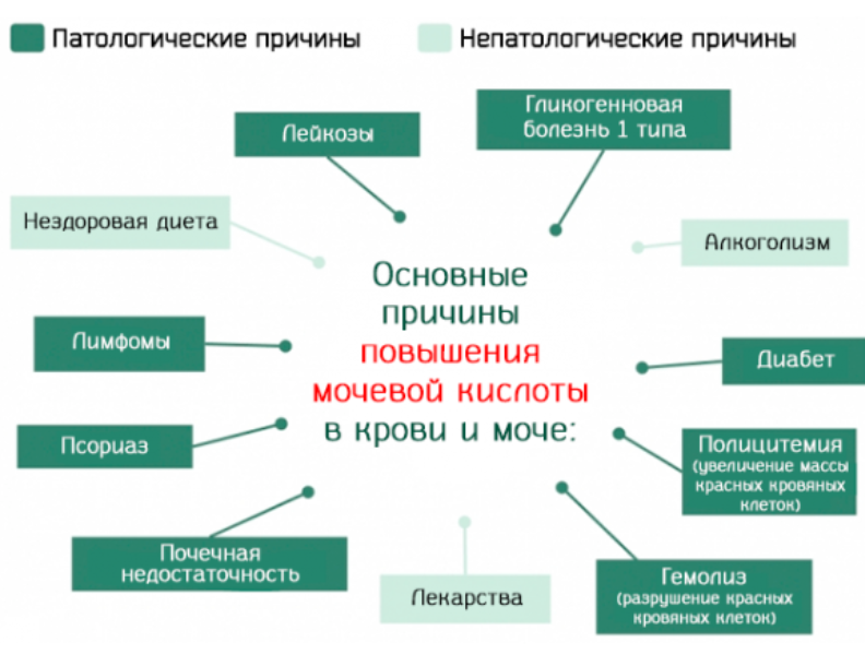 Мочевая кислота в моче: причины гипо- и гиперурикемии, правила сбора мочи