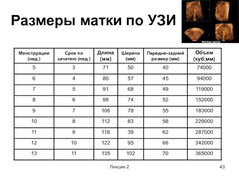Узи матки: норма размеров, как делается, на какой день цикла, фото расшифровка