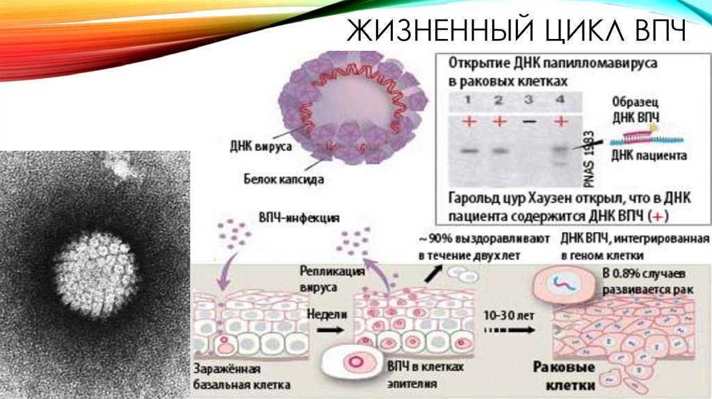 Вирус папилломы человека (впч)