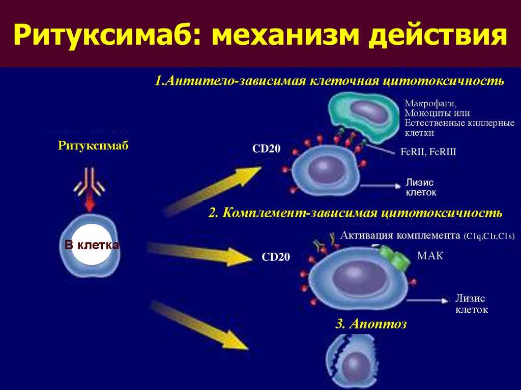 Ритуксимаб в лечении лимфомы