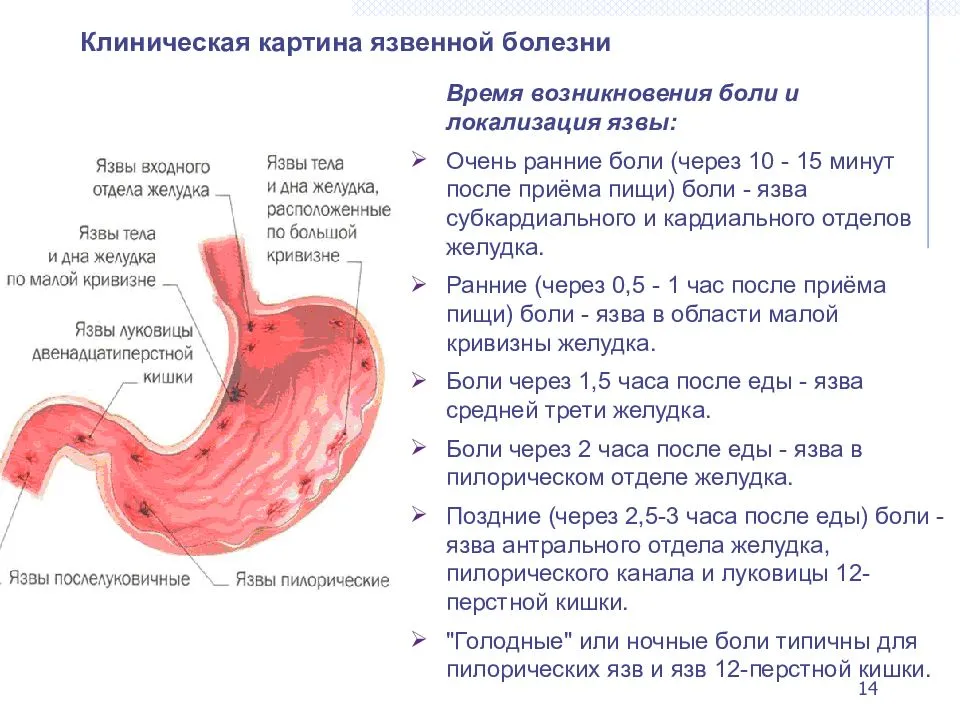 Не работает желудок болит голова