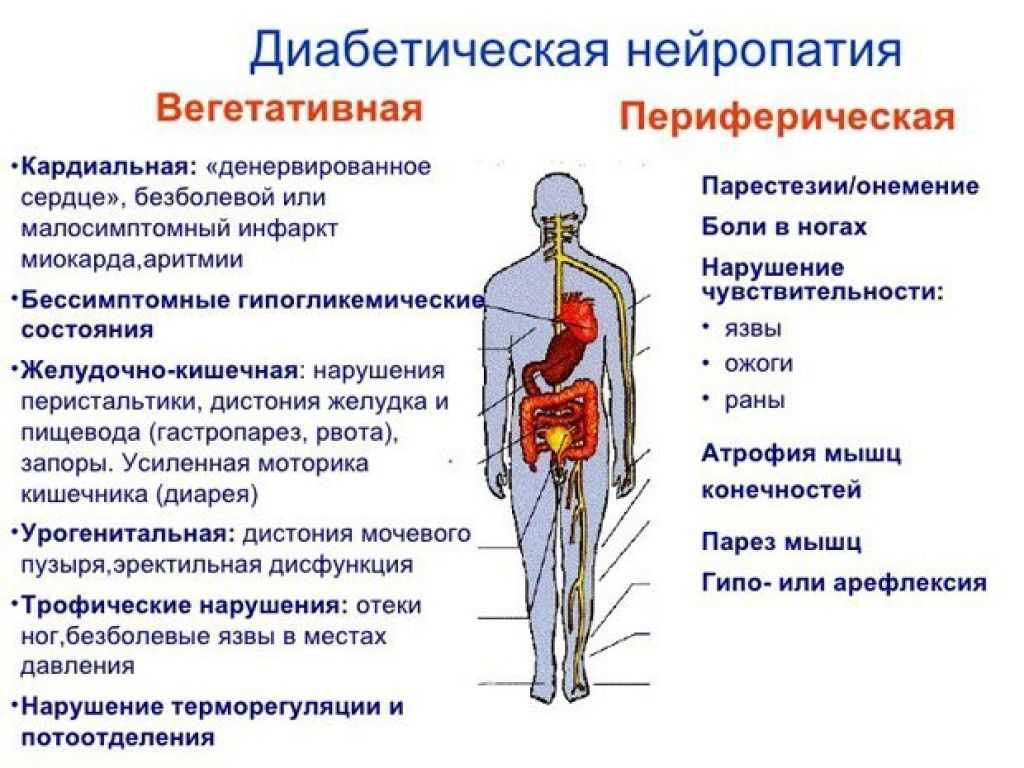 Полинейропатия - лечение, симптомы, причины, диагностика | центр дикуля