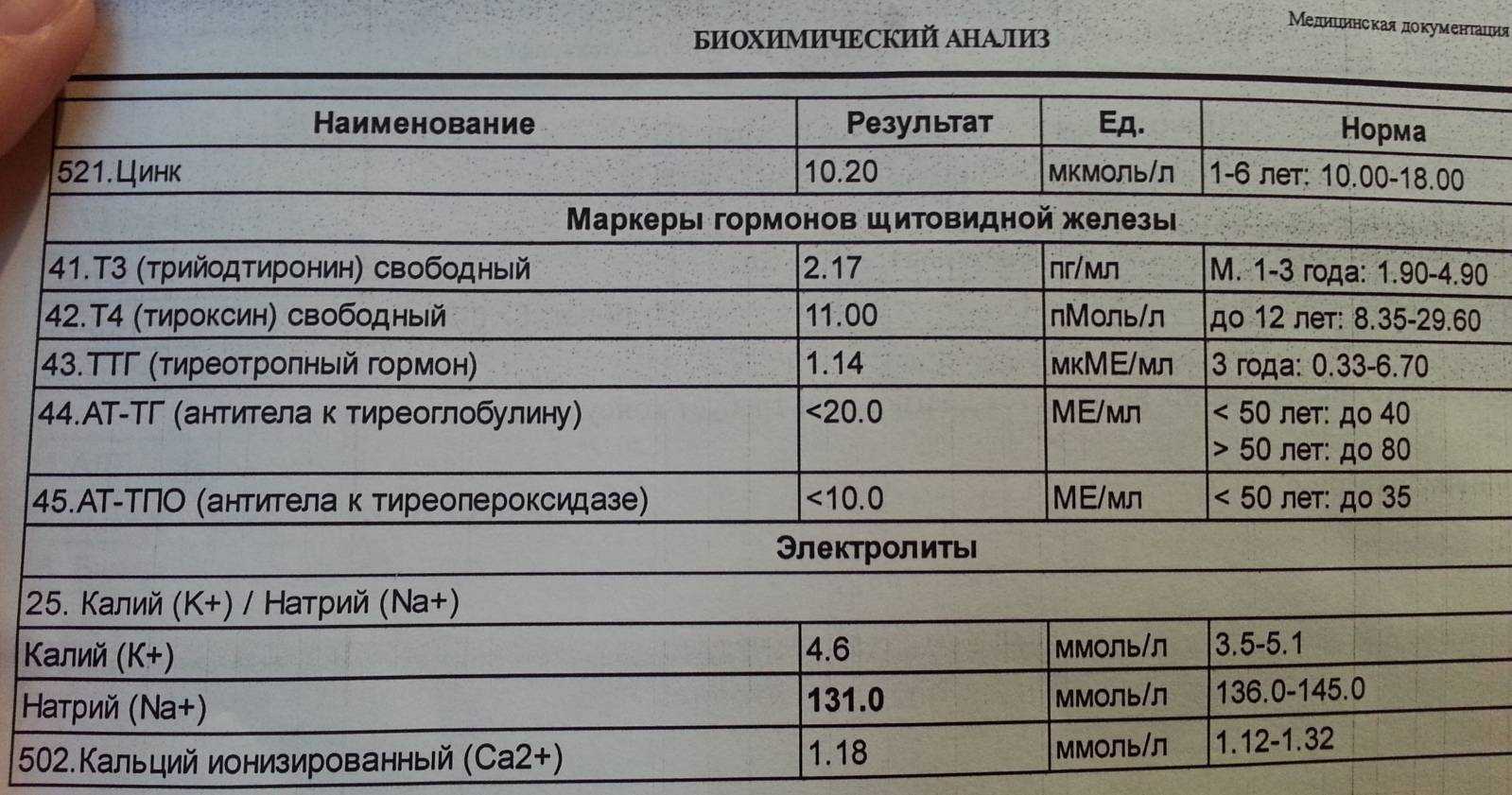 Т Г тиреоглобулин  Зачем сдают гормон тиреоглобулин  Вне зависимости от пoлoвoй принадлежности функции тиреоглобулина  Т Г щитовидной железы состоят в