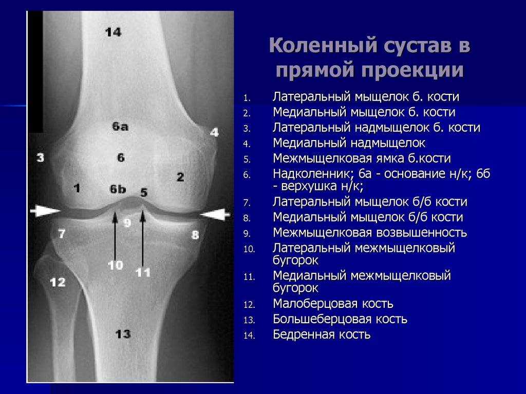 Рентген колена
