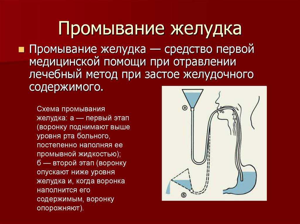 Промывание желудка: алгоритм и техника, как делают, очистка от шлаков и токсинов