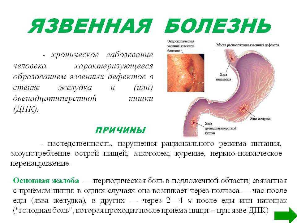 Тошнота при гастрите, может ли тошнить, как избавиться, чем снять, как убрать, что делать для лечения?