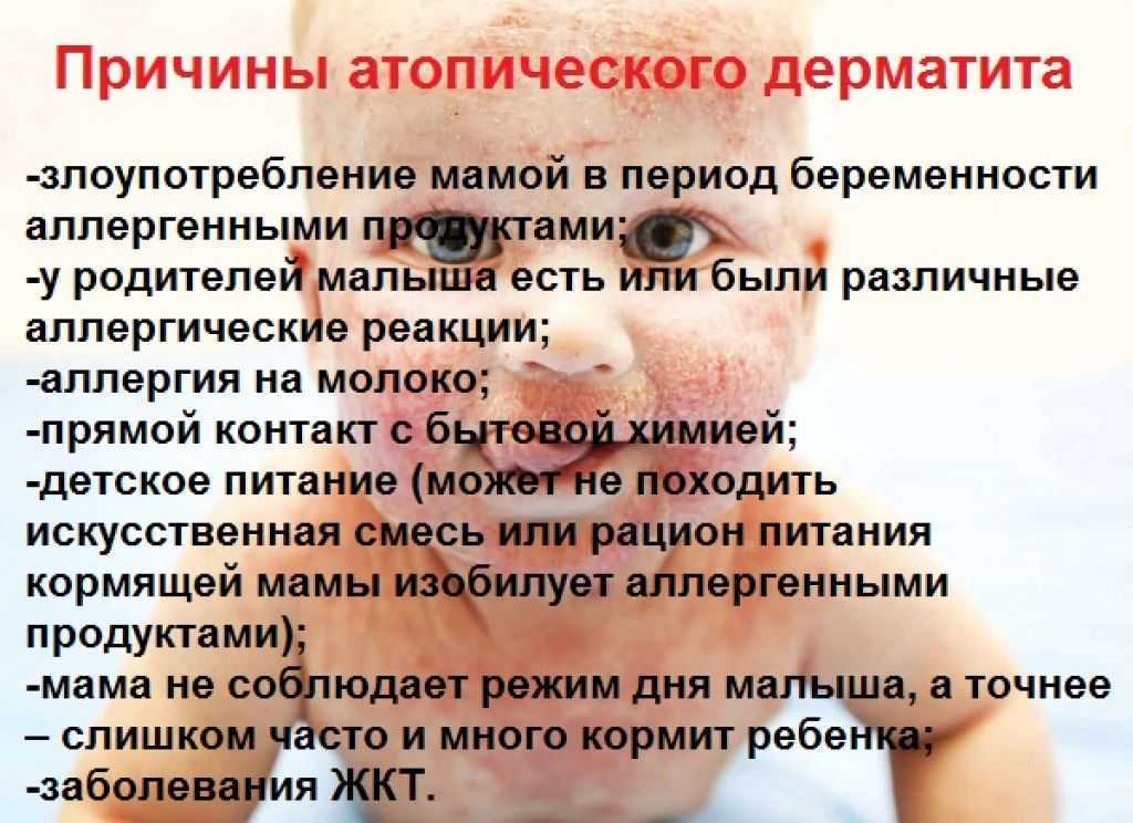 У новорождённого на лице белые прыщики, что это?
