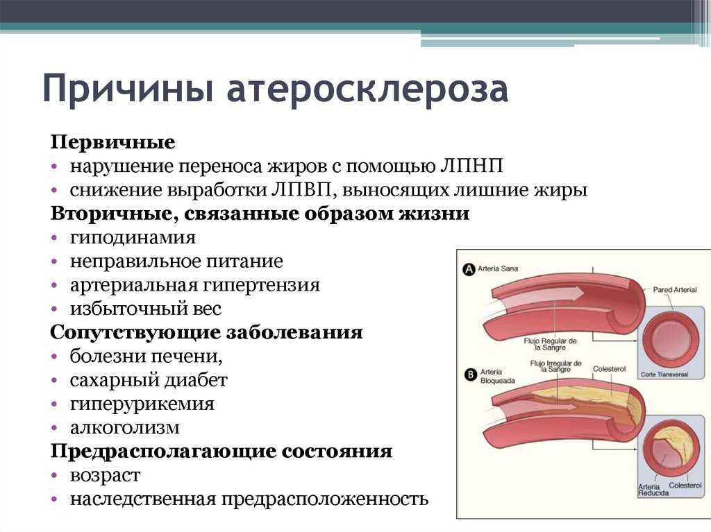 ✅ дипиридамол - отзывы, инструкция - vrach-med.ru