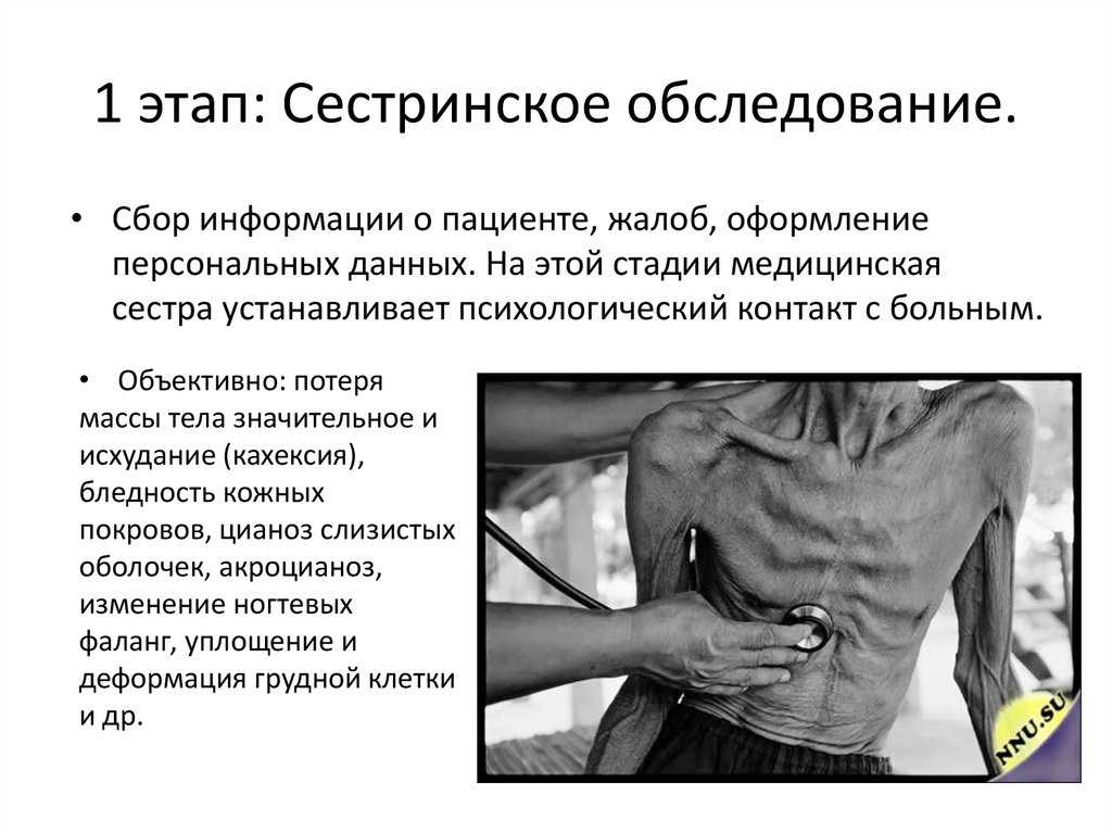 Туберкулез легких – признаки, симптомы, диагностика и лечение