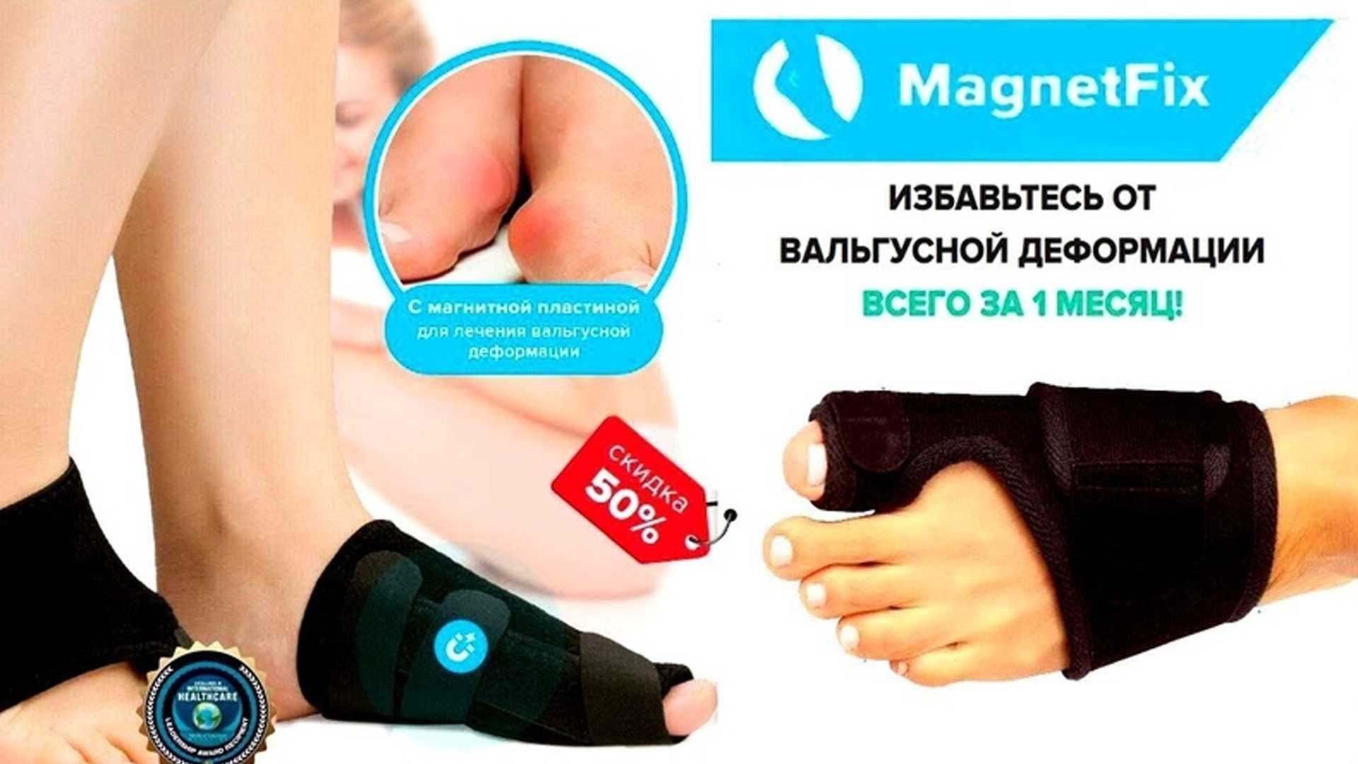 Искривление пальцев на ногах: патология и её лечение