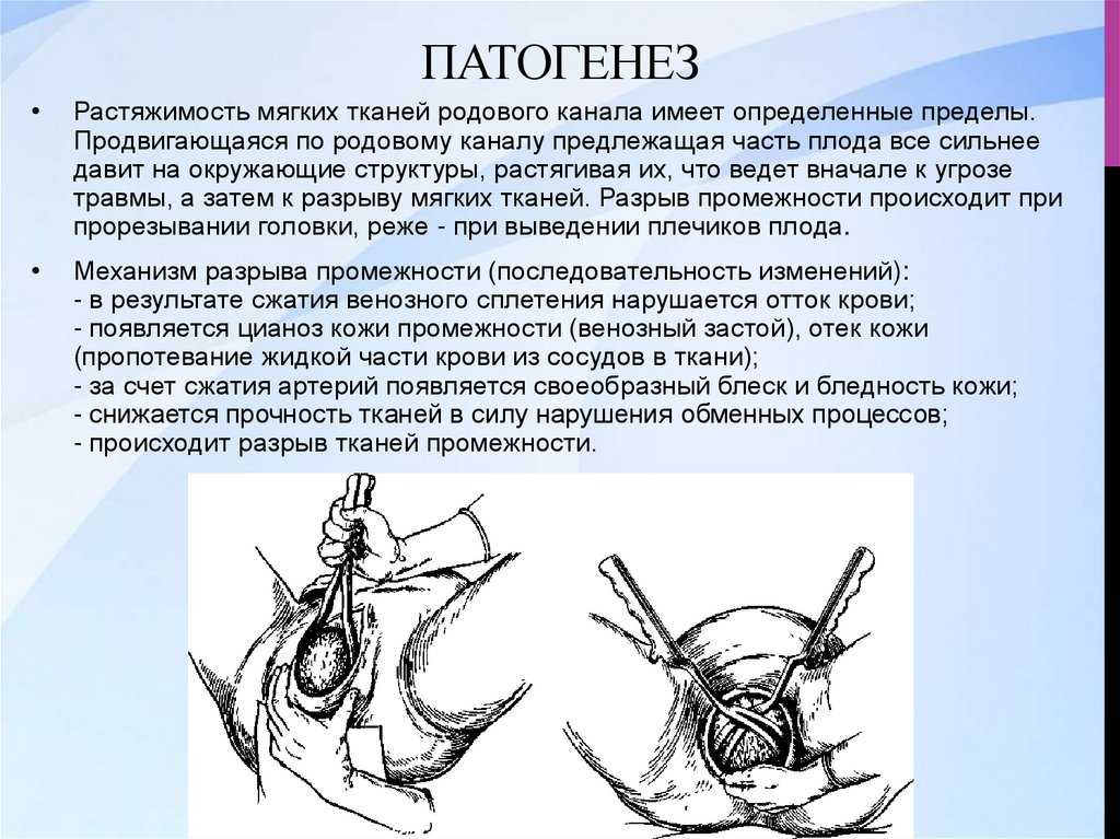 Как понять, что швы после родов зажили - mums.ru