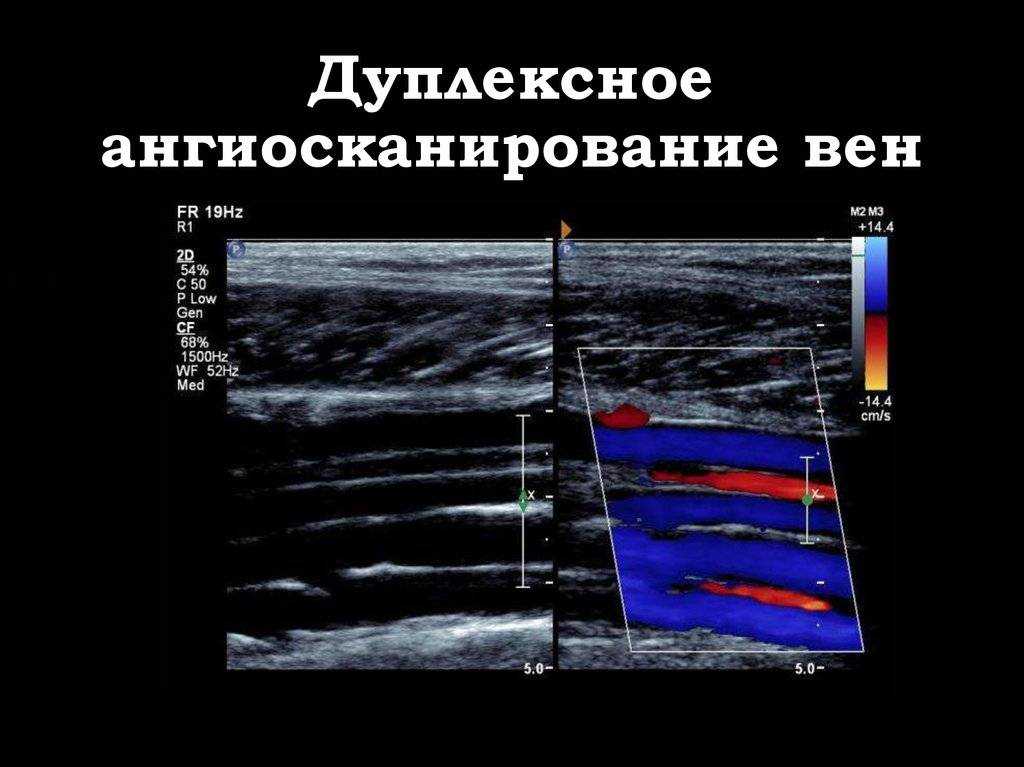 Проверка сосудов, что лучше кт, узи или мрт?