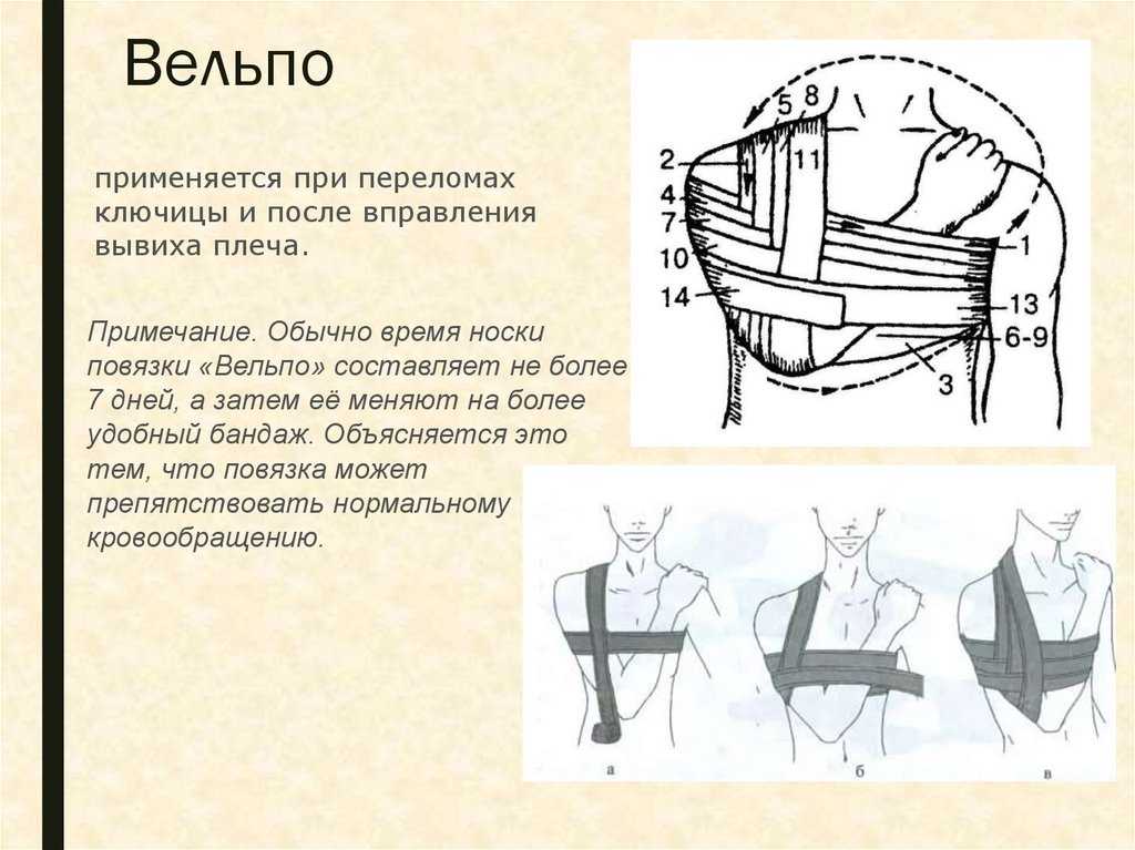 Бинтовые повязки. десмургия